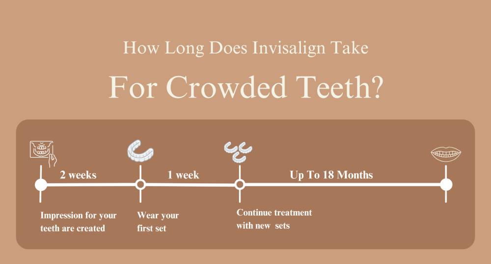 Crowded teeth example