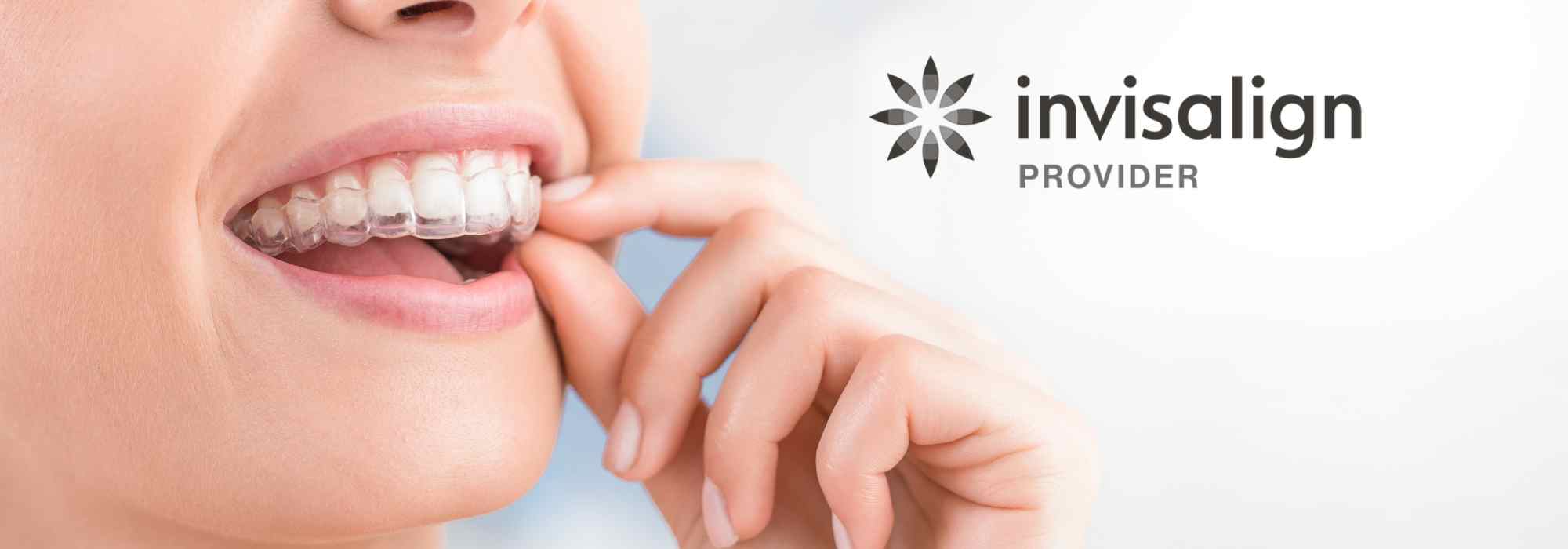 Invisalign-Edmonton.ca